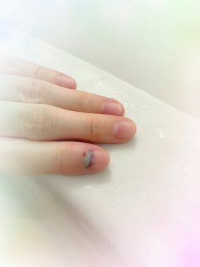 【多治見あんな】ここ1年で一番痛い思い